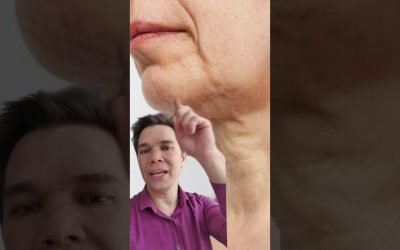 Botox Nefertiti: o que a toxina faz no pescoço e no contorno da mandíbula