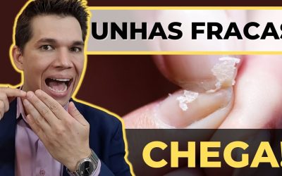 Unhas fracas e quebradiças: causas e o que ajuda de verdade